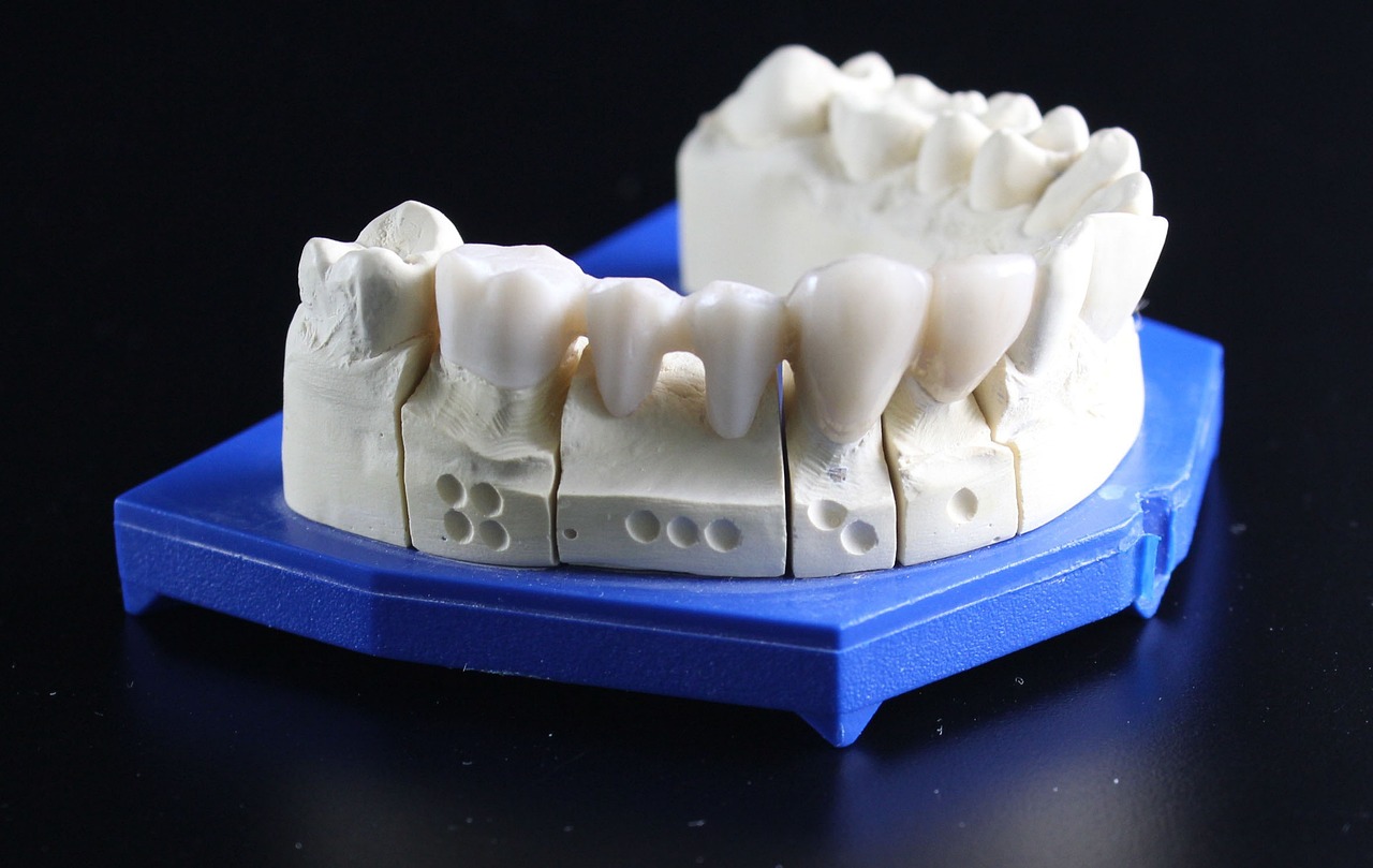 Aspen Dental Reviews in Cabot, AR - Contractor Payment Still Pending