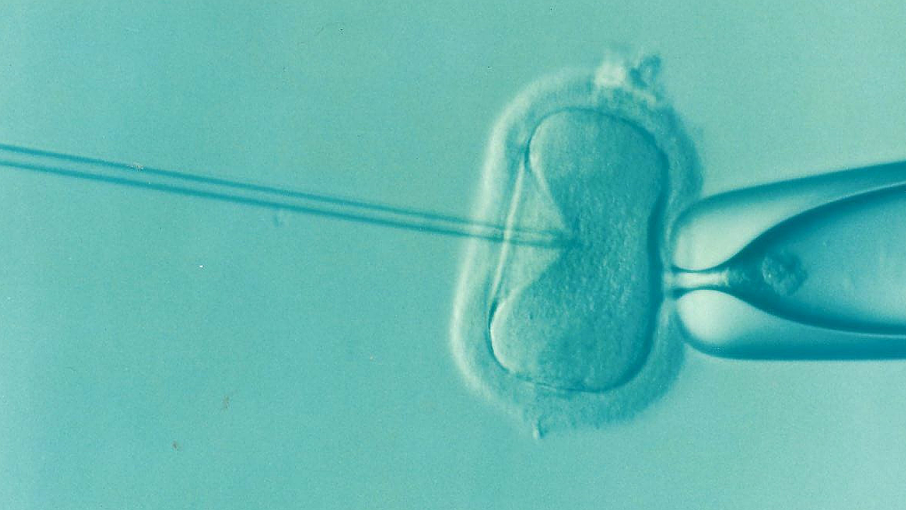 Donor Egg IVF: A Comprehensive Guide for Intended Parents