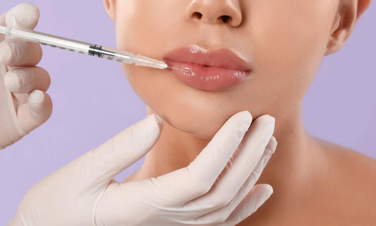 The Cost of Lip Filler in Sacramento Explained