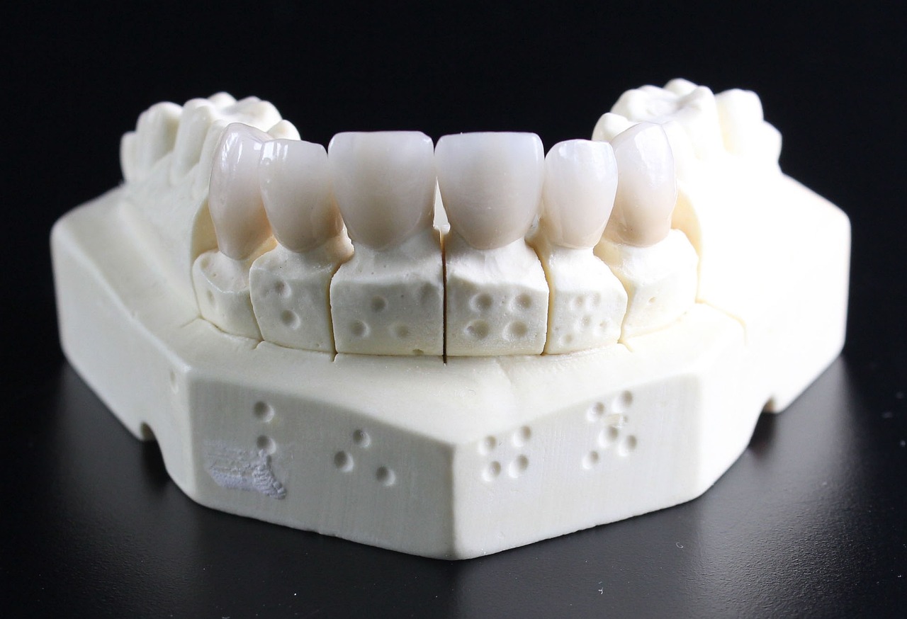 All-On-X Dental Implants Pembroke Pines: Say Goodbye To Dentures For Good