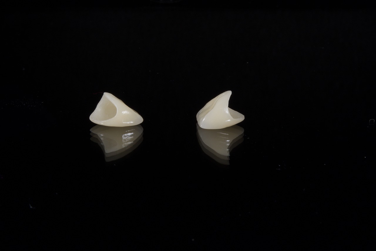 Discover The Top Providers Of Dental Veneers In Tucson, AZ