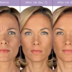 juvederm washington dc