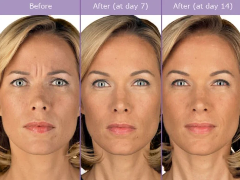 juvederm washington dc